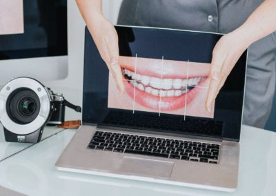 Cyfrowe projektowanie uśmiechu (DSD) - Dentysta Milicz.